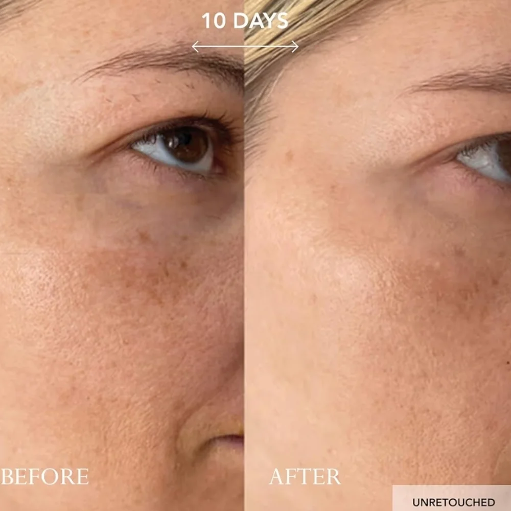 Kat Burki experience rejuvenating